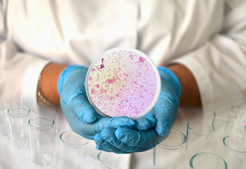 a girl in a medical gown and gloves holds a photo gonorrhea from a microscope in a round frame - obrazy, fototapety, plakaty