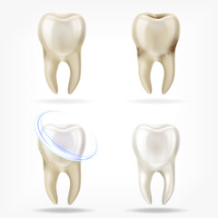 Vector set of 3d realistic clean and dirty tooth , clearing tooth process. Oral Care, teeth restoration