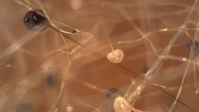 Microscope Mold Sporangium and Sporangiospore 1200x White Biology Fungi