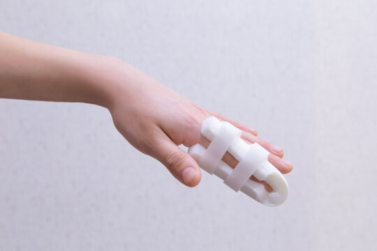 Finger immobilizer after hand injury. Retainer for recovery and release pain in the hand