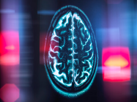 Refection of MRI brain scan on monitor display