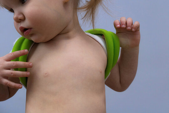 Little girl child with broken collarbone or with poor posture in orthopedic corset reclinator ring Delbe on gray blue background. Treatment of spine and collarbone injuries at Toddler and kid.