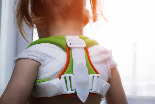 Little girl child with broken collarbone or with poor posture in orthopedic corset reclinator ring Delbe on gray blue background. Treatment of spine and collarbone injuries at Toddler and kid.