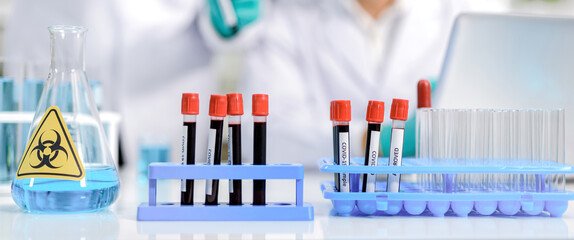 At the blood supply and many select tubes targeting the virus today. Inside the chemistry lab