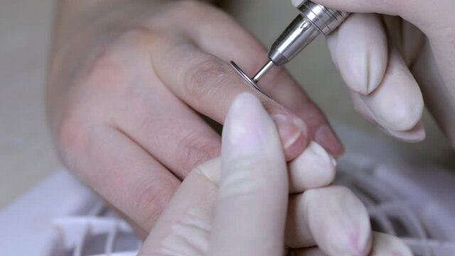 The beautician removes the keratinized part of the skin from the patient's hands with a disc. Woman's problematic diabetic hand. Dry flaky skin on the fingers. Hand care during the cold period.