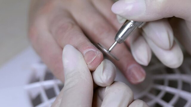 The beautician removes the keratinized part of the skin from the patient's hands with a disc. Woman's problematic diabetic hand. Dry flaky skin on the fingers. Hand care during the cold period.