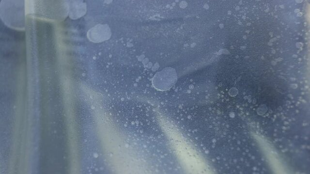 The peritoneal dialysis fluid is pouring out of the bag very quickly.