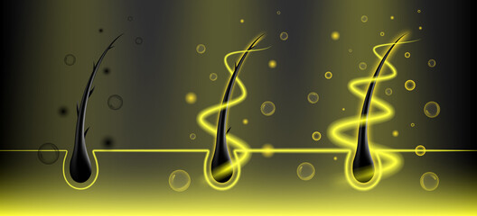 Repair damaged hair to healthy hair. Hair follicle science treatment.