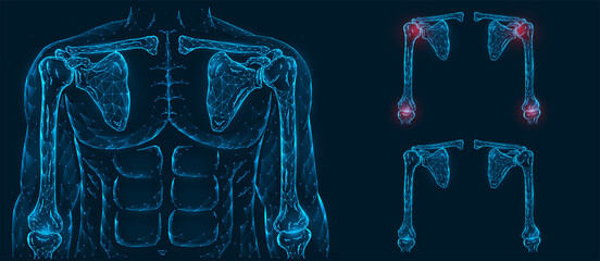 Pain, injury and inflammation of the shoulder and elbow joints front view polygonal illustration on a blue background. Healthy and sore joints. - obrazy, fototapety, plakaty