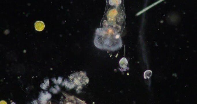 The rotifers commonly called wheel animals or wheel animalcules, make up a phylum (Rotifera) pseudocoelomate animals under the microscope.
