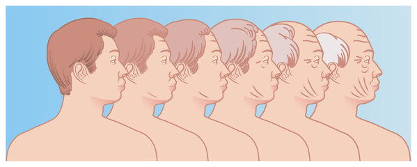 Simple illustration shows the progressive aging of the face of a man.