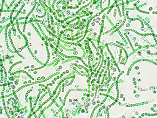 Nostoc sp. algae under microscopic view - obrazy, fototapety, plakaty