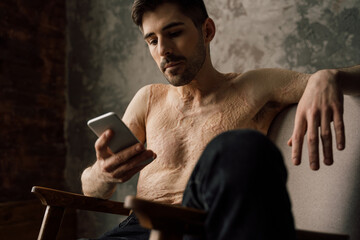 Man with scars after burn sitting at comfortable armchair and enjoying spending weekend leisure time
