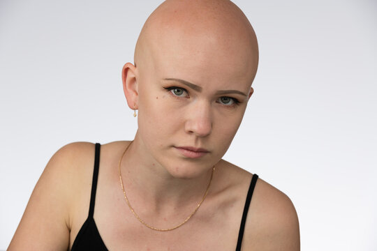 Young urban woman with blue eyes and a fair complexion poses for the camera.