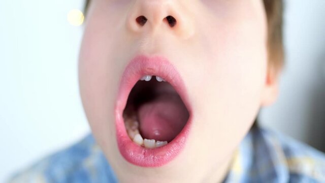 Small Child, Kid Performs Articulation Exercises For Mouth, Rolls The Tongue Into A Tube, Oral Cavity, Close-up, Vocals, Dental Concept, Speech Therapy