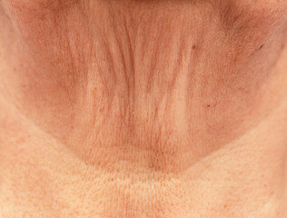 Fototapeta premium aged skin in the chin area as a background