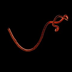 Ebola Virus oder Parasit, microskopische Ansicht