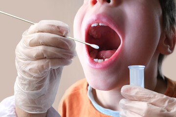 doctor takes a cotton bud from child&rsquo;s mouth to analyze the saliva, mucous membrane for DNA tests, COVID-19, to determine paternity or presence of virus, SARS-CoV-2 epidemic, coronavirus concept