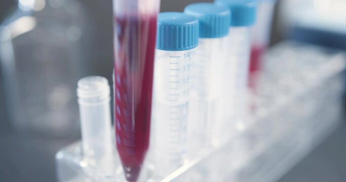 Corona virus antibody test tube with blood is put into a stand and taken out for further analysis