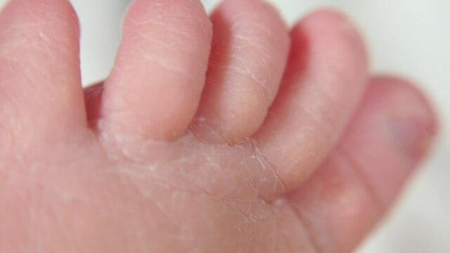 Macro dry skin of a child's leg. Change of the upper layer of the epithelium in a newborn. The movement of the camera on dryness.