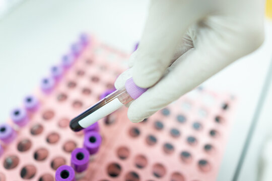Hospital samples of donated blood indoors, high quality