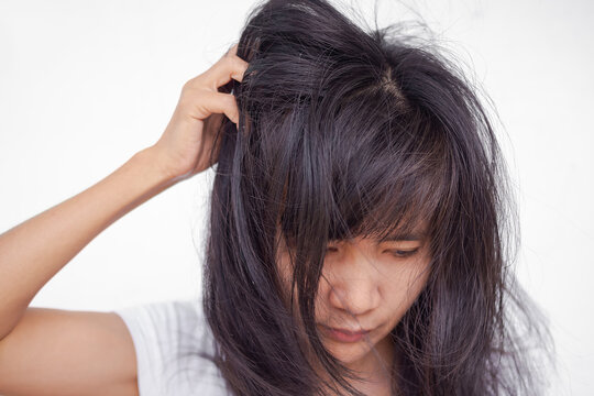 Dandruff On Hair Of Girl. Woman Is Scratching Head Because Problem Rod From Fungus On The Scalp With Messy Hair. Authentic Thailand Black Hair And Skin Tan. Close Up Image.