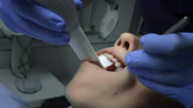 Doctor scans the patient's teeth in the clinic. The dentist holds in his hand a manual 3D scanner for the jaw and mouth. Dental health. Creates a 3D model of teeth and gums on a medical monitor.