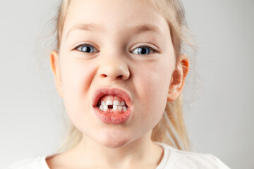 The first children's tooth fell. Portrait of a child girl with a hole in the teeth,