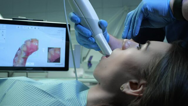 Doctor scans the patient's teeth in the clinic. The dentist holds in his hand a manual 3D scanner for the jaw and mouth. Dental health. Creates a 3D model of teeth and gums on a medical monitor.