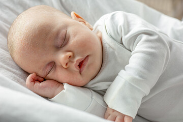 seborrheic dermatitis on baby's face. Sleeping newborn child with seborrhea on the forehead