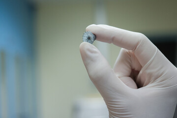 patent ductus arteriosus disease (PDA) device closure , which is congenital heart disease	