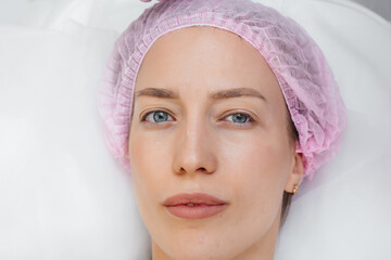 Cosmetology procedure for lip augmentation and wrinkle removal for a young beautiful girl....