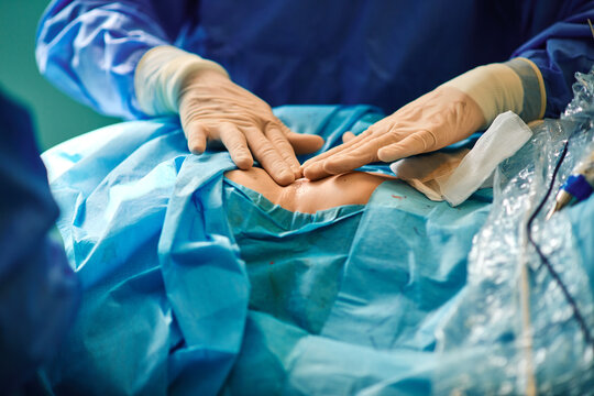 Crop unrecognizable surgeon attaching adhesive bandage on postoperative suture on breast of anonymous female patient after breast augmentation