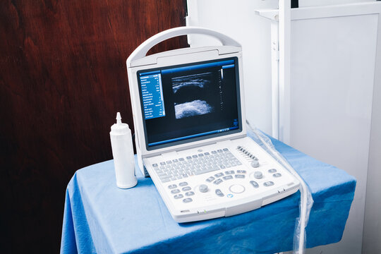 Detail of an ultrasound machine in a table with a blue clothe and a bottle of cream to make it