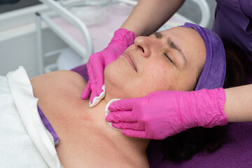 During the cosmetic procedure, the beautician wipes the skin on the face with cosmetic pads