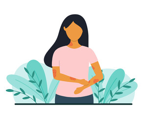 Fototapeta na wymiar Woman with skin problems. Psoriasis or eczema concept. Flat style vector illustration.
