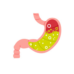 High unhealthy level of stomach acidity. Burn in belly flat cartoon illustration. Gastric problem symptoms banner design. Digestive Healthcare background