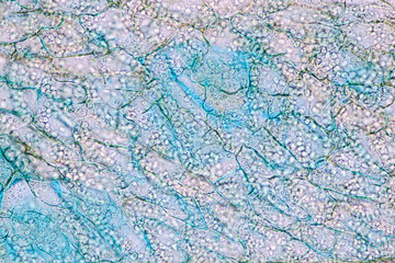 Characteristics of fungi living in wood as a group, are polyphyletic under the microscope for education.
