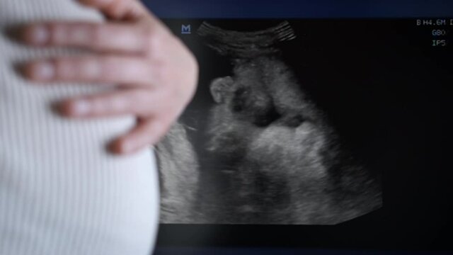 Human on ultrasound video. A happy pregnant woman caress her belly by a video of her unborn child in the room.