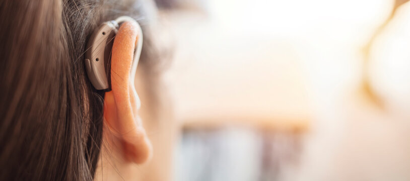 Deaf woman wearing hearing aid. Digital hearing aid in woman's ear. Brunette Woman with Modern Hearing Aid. Hearing Impaired.