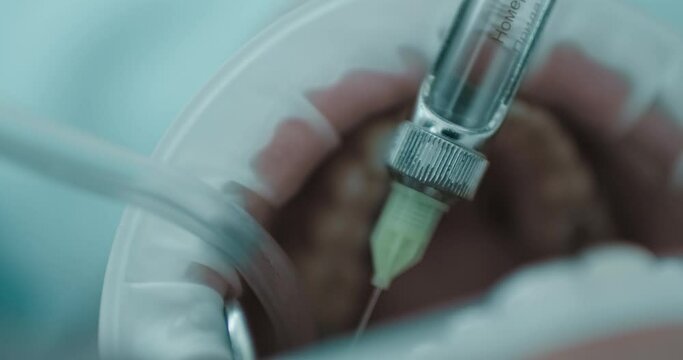 Close-up a male patient wearing disposable mouth opener while the dentist putting in his mouth a saliva ejector and syringe with a needle and injection fluid in it for treating a patient's teeth.
