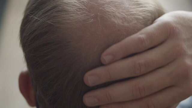 Close up of hand slowly rubbing man's bald spot on head
