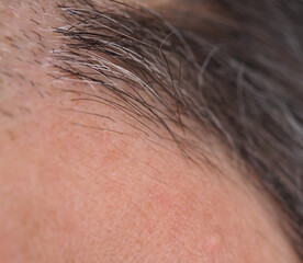 Obraz premium human hair follicles