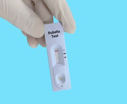 Scientists or Lab Technologists hold a device of Rubella IgG, IgM rapid screening test, showing negative results.