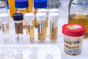  Investigation of sars-cov-2 virus in humans in a wastewater laboratory, conceptual image