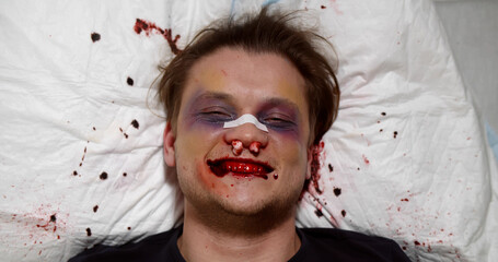 Top view of crazy young man with bleeding face lying on hospital bed and laughing