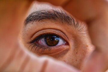 Eye