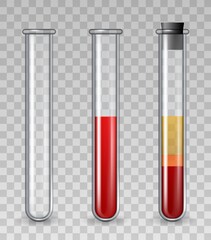 Test tubes with blood. Realistic glass medical tube empty, filled with red cells, platelet rich plasma. PRP dermatology therapy vector set