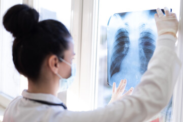 Pulmonologist looking at lung x-ray prescribing treatment to patient, healthcare