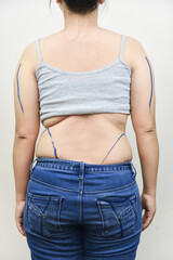 Beautiful, fat, beautiful, wear gray, suitable for medical purposes for those who want to lose weight.